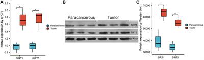 Constructing a signature based on the SIRT family to help the prognosis and treatment sensitivity in glioma patients